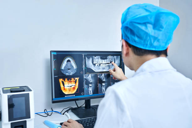 Best Knocked-Out Tooth (Avulsed Tooth) Treatment in South Hempstead, NY